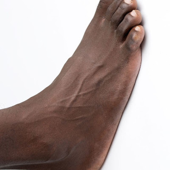 robertfoot